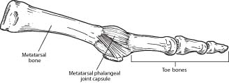 Capsulitis