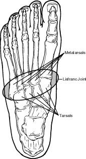 Lisfranc