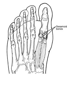 Sesamoid