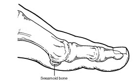 Sesamoid2