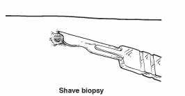 Biopsy 01